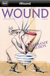 iWound