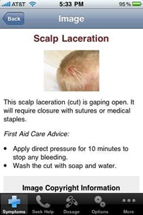 Scalp Scalp